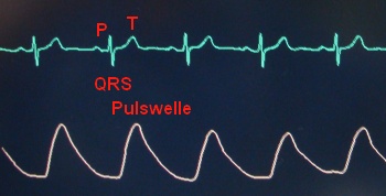 EKG und Pulswelle