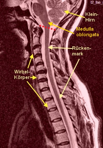 Rückenmark und Hirnstamm